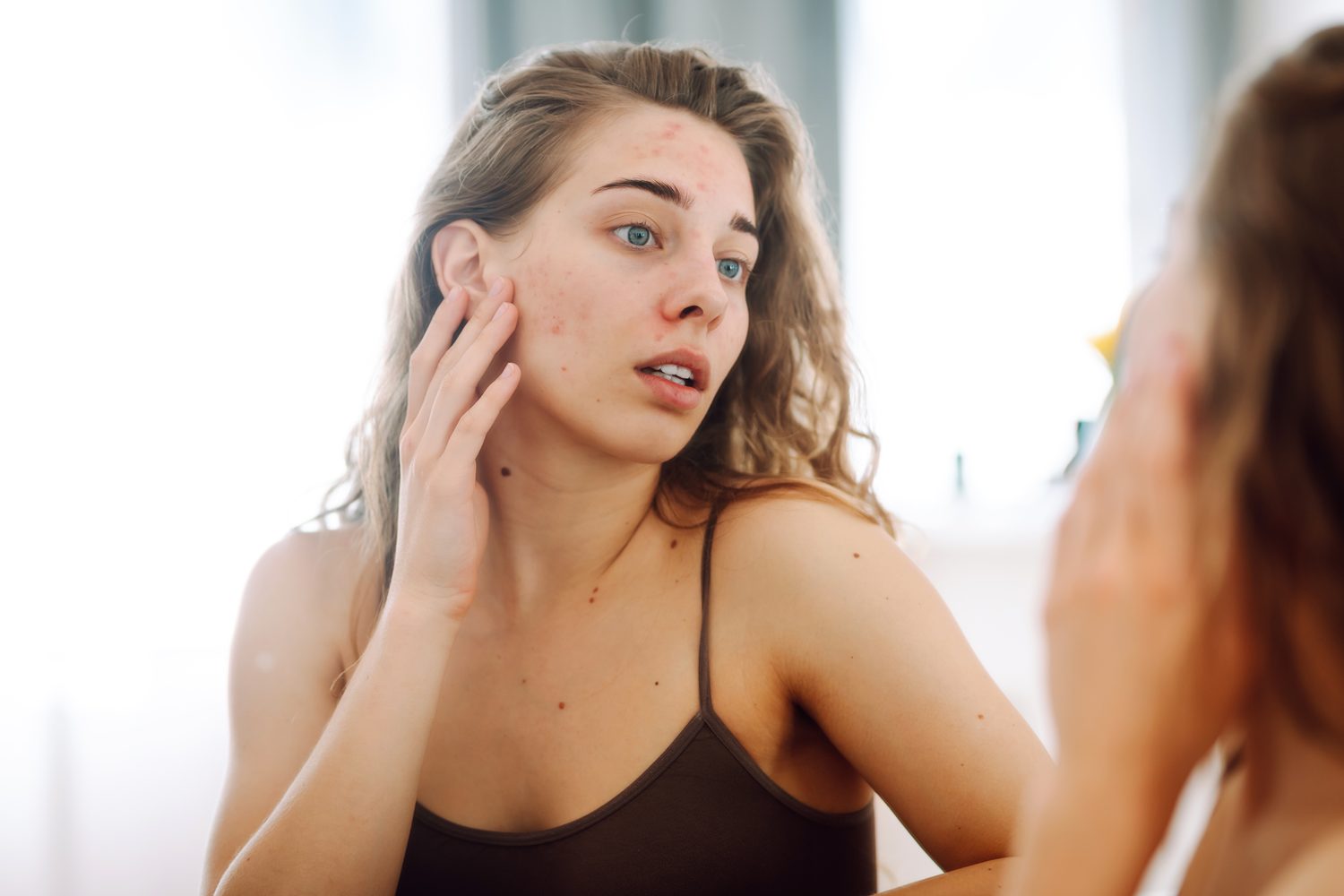 Femme observant attentivement une peau sèche au niveau de sa joue devant un miroir.